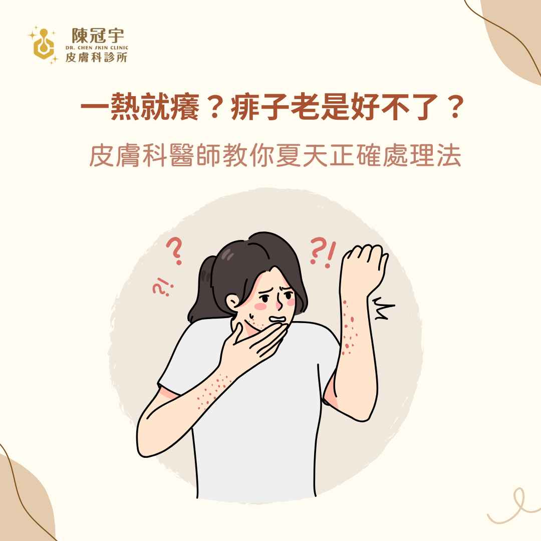 一熱就癢?痱子老是好不了?皮膚科醫師教你夏天正確處理法